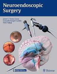 جراحی نورواندوسکوپی - نورولوژی